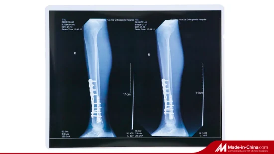 FUJI Printer Using Laser Medical X-ray Film 35X43 Cm